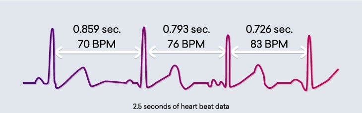 dalgalı yüksek kalp hızı